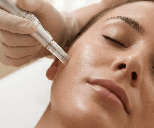 Exoglowpeel