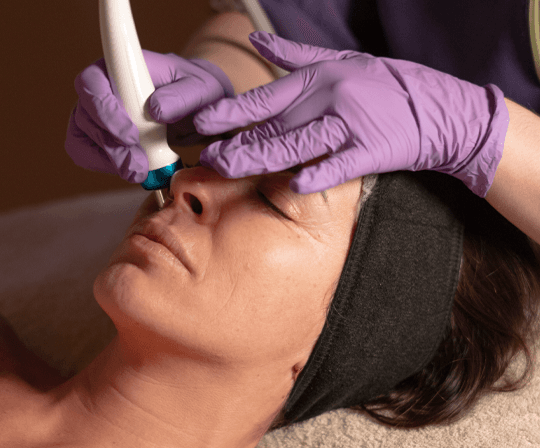 RenewAge Facial