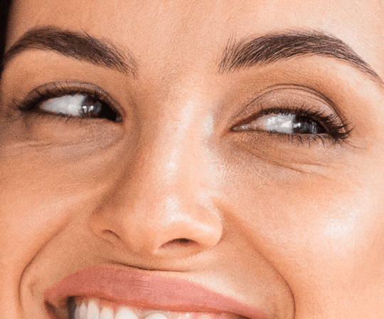 Relleno de ojeras