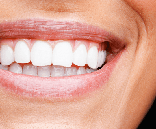 Sonrisa gingival