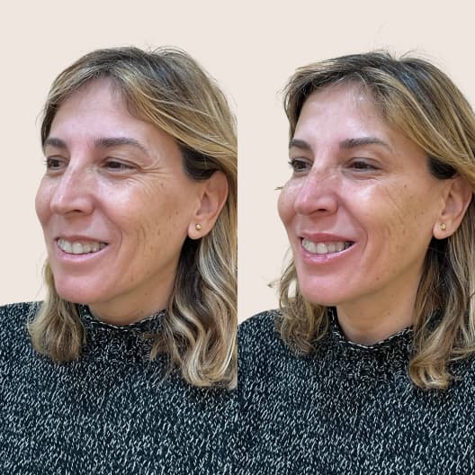 antes y despues Pack Wellaging